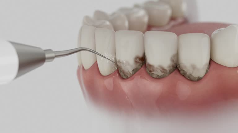 Trusted Invisalign Clear Aligners service in Catahoula, LA - Dentist Open Now